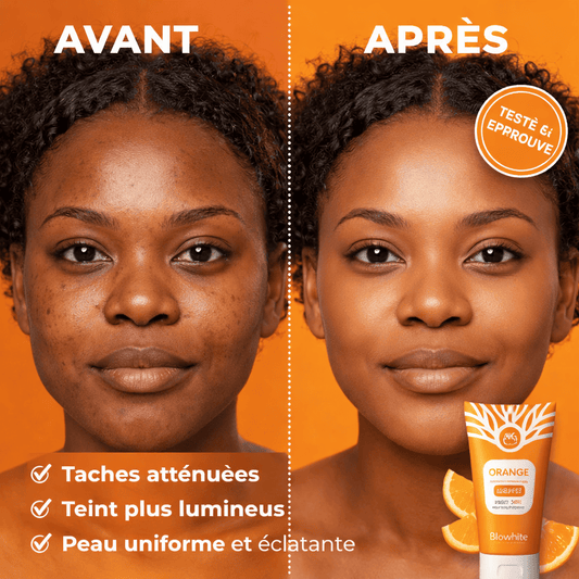 Dites adieu aux taches. Révélez votre éclat. + Un livre sur 100 Astuces Naturelles pour Prendre Soin de sa Peau